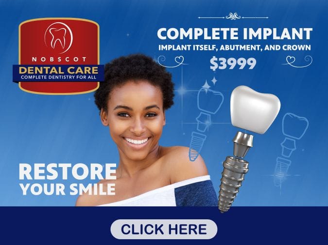 Dental implant offer